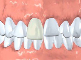 Cosmetic Dentistry in Berkeley Lake