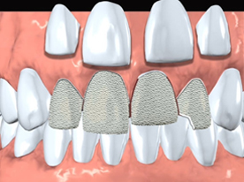 Cosmetic Dentistry in Berkeley Lake