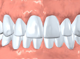 Cosmetic Dentistry in Berkeley Lake
